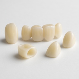 e.max CAD veneer