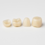 Temporary teeth