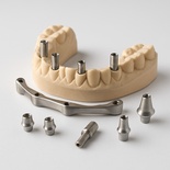 Plaster implant guide