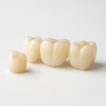 Full Zirconia Crown / Bridge（Bruxzir)
