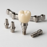 Implant Layerd Zirconia crown