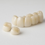 Layered Zirconia Crown / Bridge