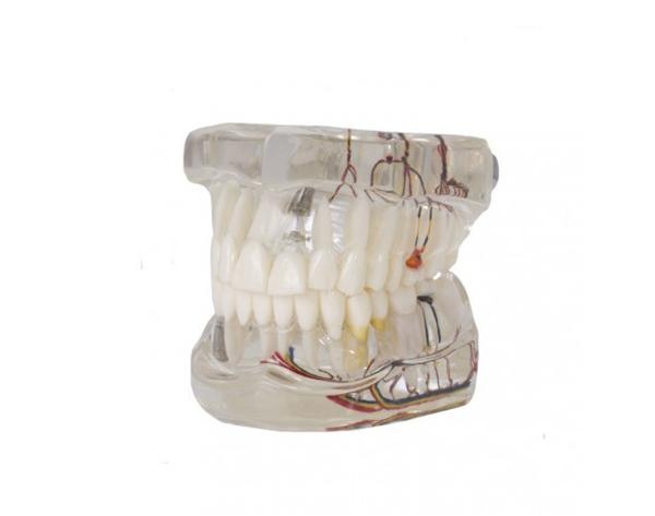 Nerve Implant Demonstration Model for Dental Training and Education