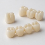 Dentsply Sirona Cercon veneer