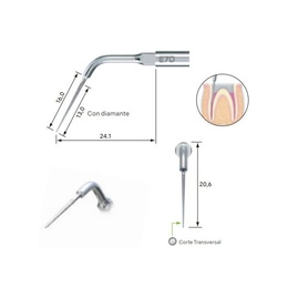 Ultrasonic Endodontic Tips E for Precise Root Canal Treatment