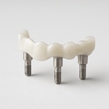 Implant Zirconia Coping for try in