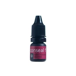 Conseal F Light-Cured Fissure Sealant with High Fluoride Release