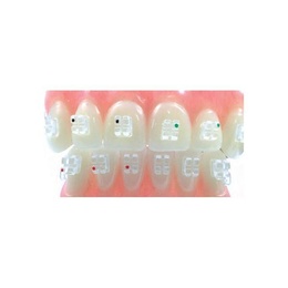 Sapphire Orthodontic Brackets Set of 20 Pieces