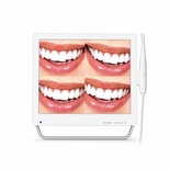 High-resolution intraoral imaging display