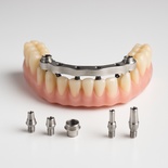 All on 6 (include full denture with ATT ,clips)