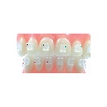 Sapphire Brackets (20 pcs)