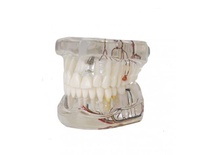 Nerve Implant Demonstration Model for Dental Training and Education