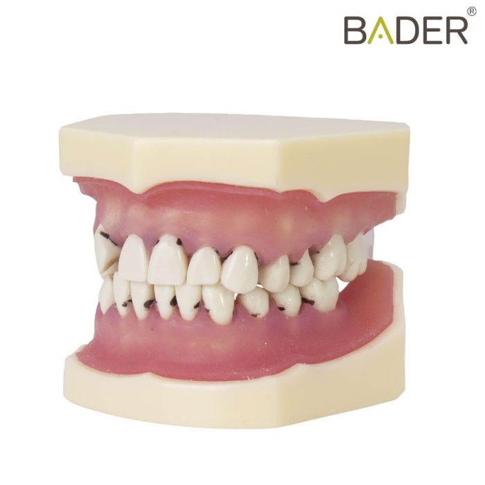 Periodontal Typodont for Dental Training and Practice