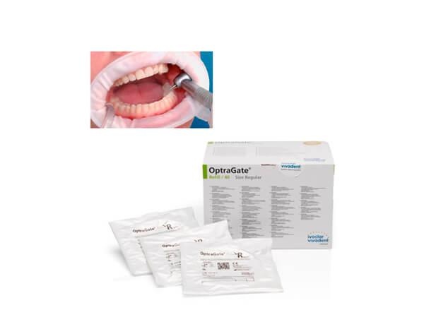 OptraGate: Latex-Free Mouth Opener (80 pcs)