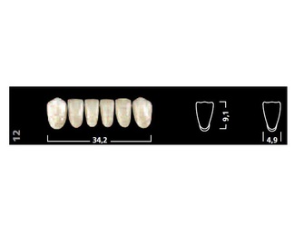 Ivostar Lower Anterior Acrylic Teeth - Pack of 6 Units