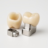 MK1 Attachment