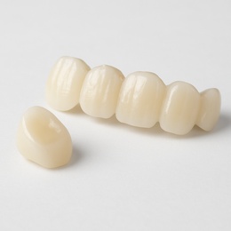 e.max crown / bridge
