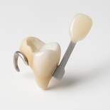 Porcelain shoulder margin