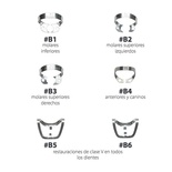 Universal Clamps with gingival retraction
